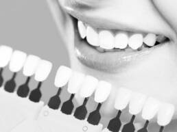 MELHOR DENTISTA BRASIL CAMPINAS CURITIBA PROTOCOLO CARGA IMEDIATO IMPLANTE DENT&Aacute;RIO DENTISTA PARA BRASILEIRO INVISALIGN VALINHOS PAUL&Iacute;NIA CAMBU&Iacute; TAQUARAL ALPHAVILLE NOVA CAMPINAS RESIDENCIAL SWISS PARK