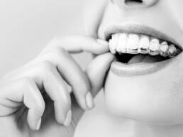 MELHOR DENTISTA BRASIL CAMPINAS CURITIBA PROTOCOLO CARGA IMEDIATO IMPLANTE DENT&Aacute;RIO DENTISTA PARA BRASILEIRO INVISALIGN VALINHOS PAUL&Iacute;NIA CAMBU&Iacute; TAQUARAL ALPHAVILLE NOVA CAMPINAS RESIDENCIAL SWISS PARK